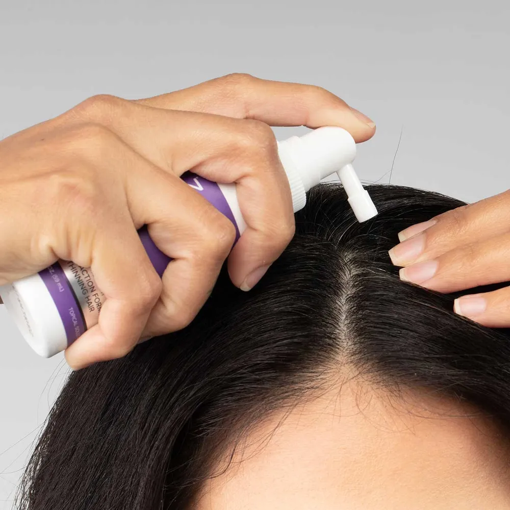 FOLIGAIN Kolmivaikutteinen Täydellinen Kaava Oheneville Hiuksille Naisille, jossa 10 % TRIOXIDIL®