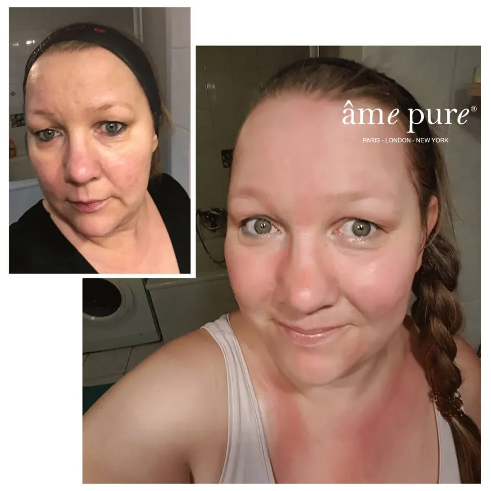 WrinklEraser™ BASIC âme pure