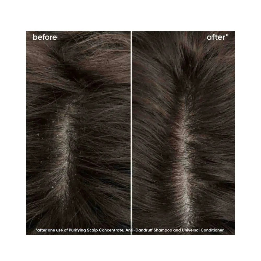 Biolage -päänahan synkronointipuhdistus päänahan konsentraatti