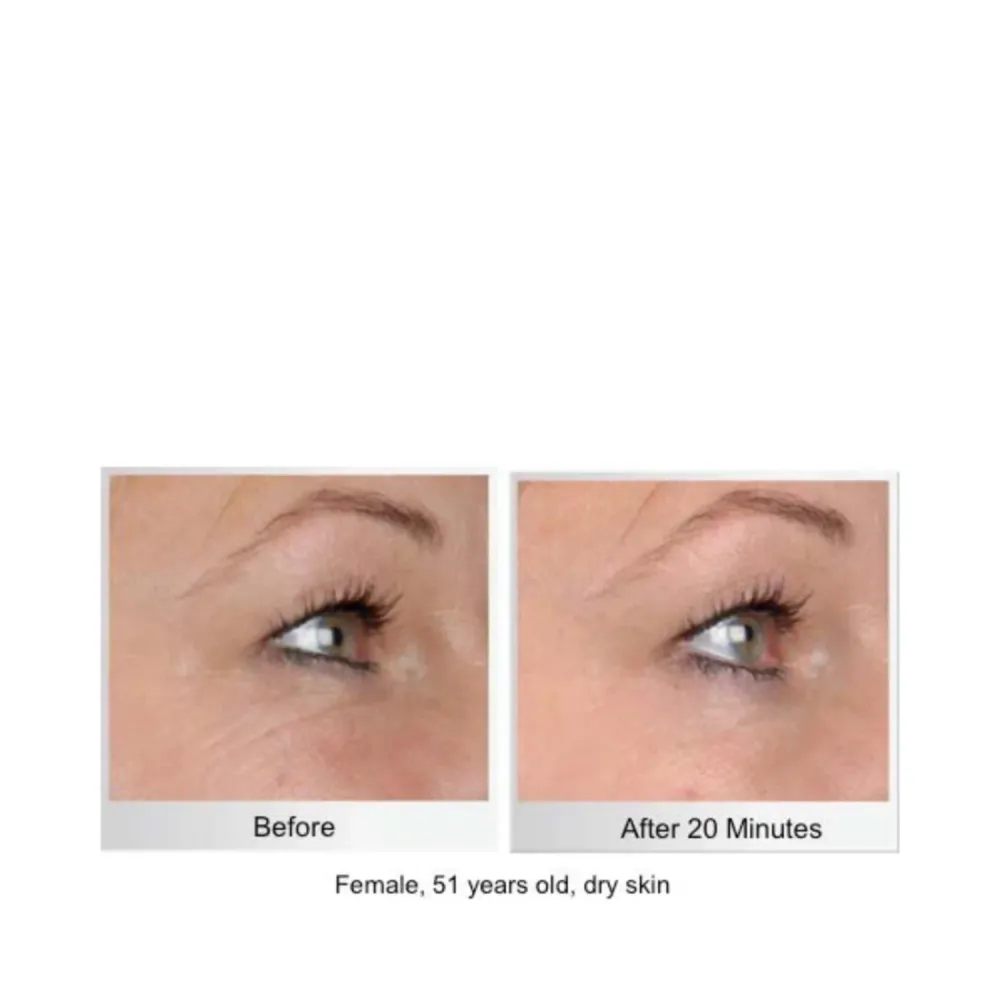 Circcell Insight Collagen -silmänhoitonaamiot