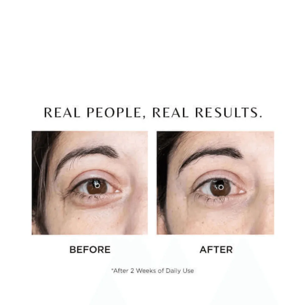 Cosmedix I-Complex Advanced Eye Gel