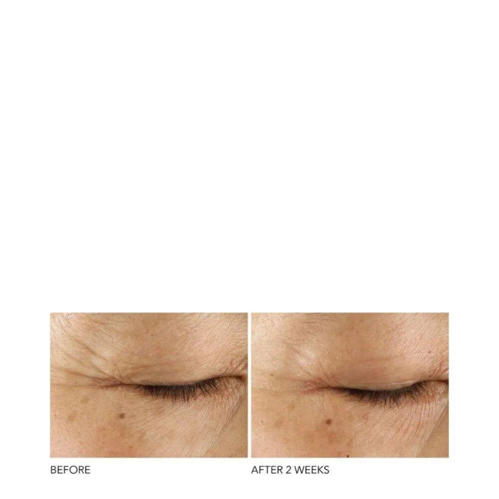 Tohtori Dennis brutto edistynyt retinol + ferulinen kolminkertainen korjaus silmäseerumi Dr Dennis Gross