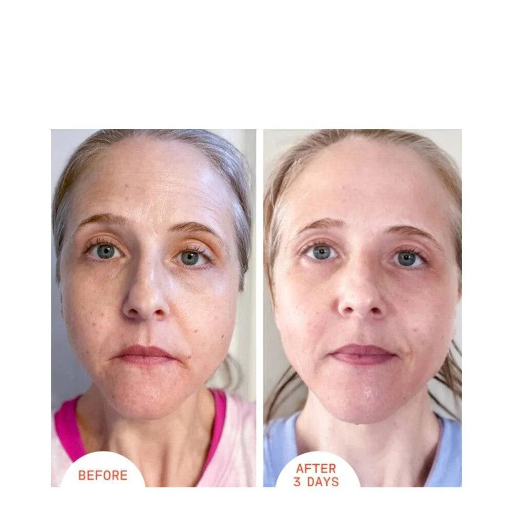Tohtori Dennis Gross Alpha Beta Peel Extra Strength Formula Dr Dennis Gross