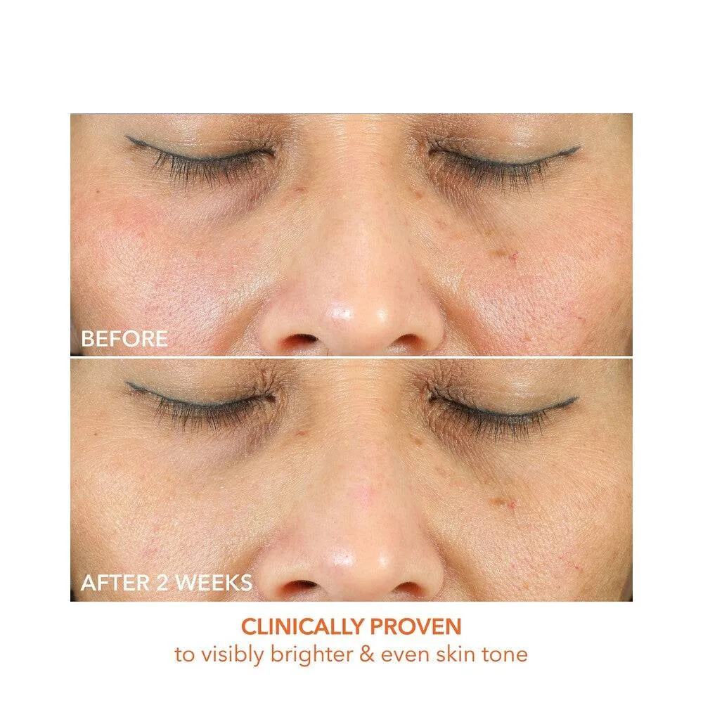 Tohtori Dennis Gross-vitamiini C + Maictic Oil-Free Radiant-kosteusvoide Dr Dennis Gross