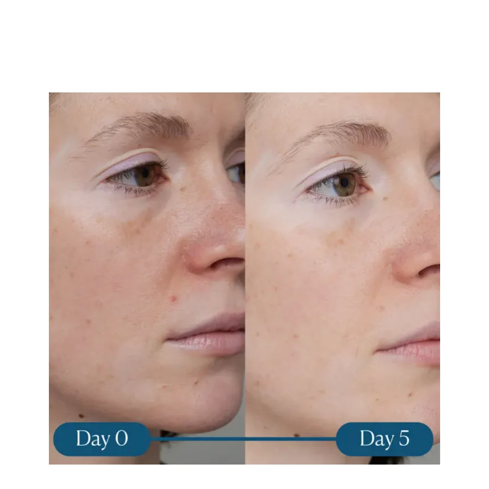 Elemis dynaaminen pinnoitus Super-C-seerumi