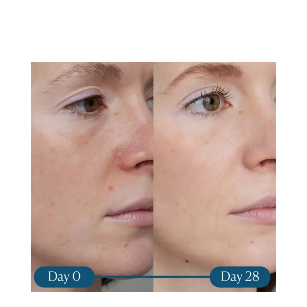 Elemis dynaaminen pinnoitus Super-C-seerumi