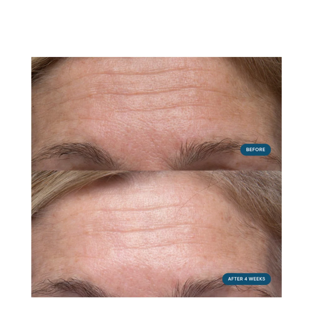 Elemis pro-collageeniaamun matriisi