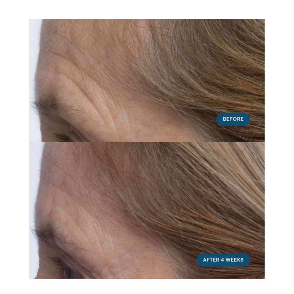 Elemis pro-collageeniaamun matriisi