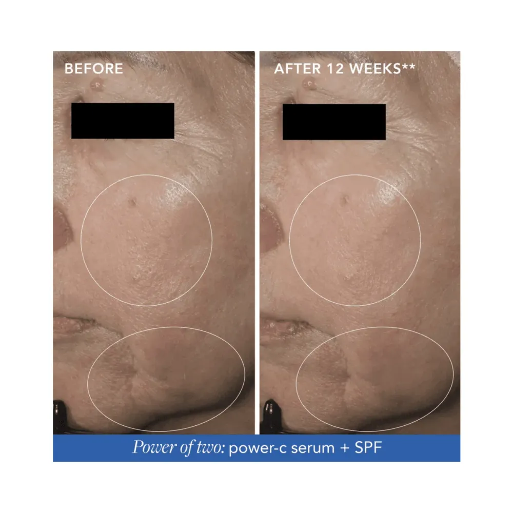 Image Skincare IMAGE MD palauttava Power-C -seerumi
