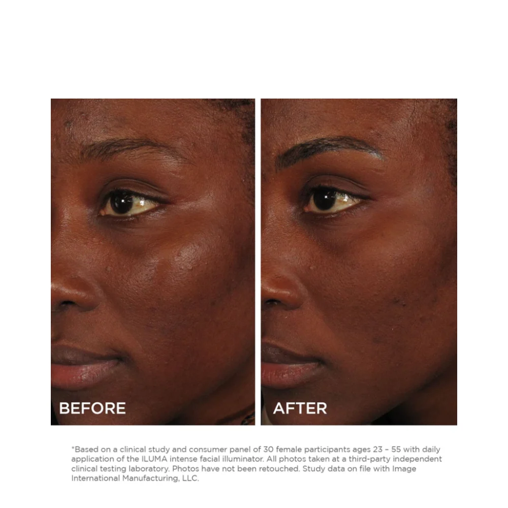 Kuva ihonhoito iluma intensiivinen kasvovalaistus Image Skincare