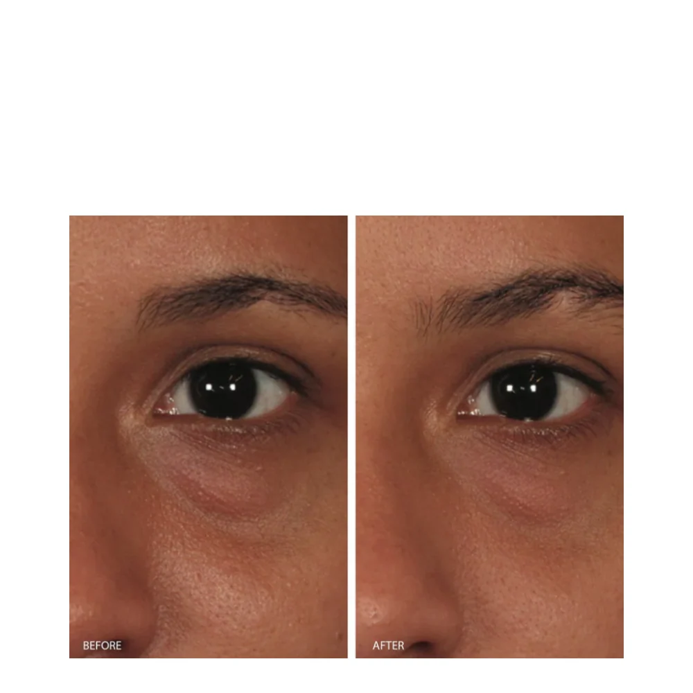Kuva ihonhoitoa tasapainottava silmähuoltogeeli Image Skincare