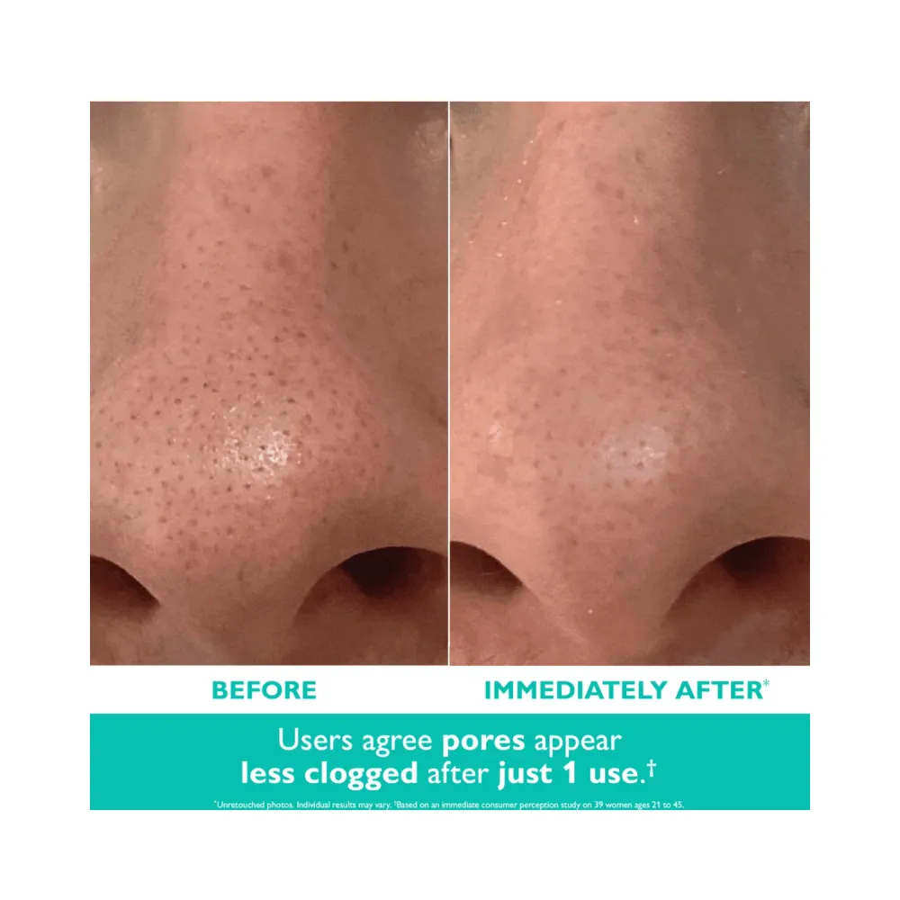 Peter Thomas Roth Even Smoother Microdermabrasion kuoriva huokoshoito