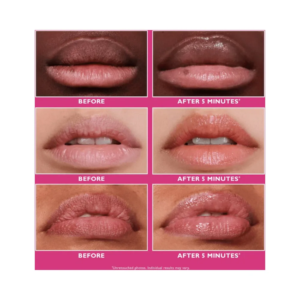 Peter Thomas Roth Instant FirmX huulten täyteaine