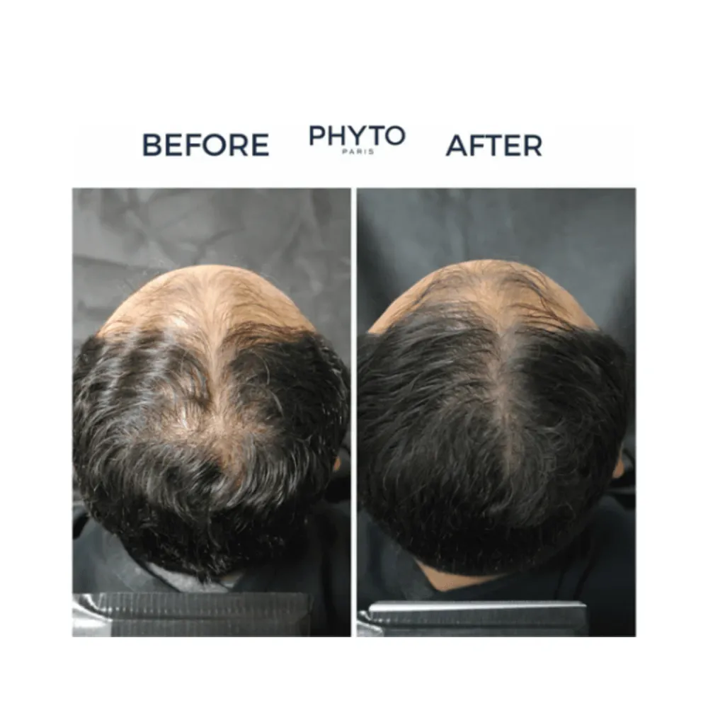 Phyto Phytosyane-Men-tiheys hiusseerumi miehille