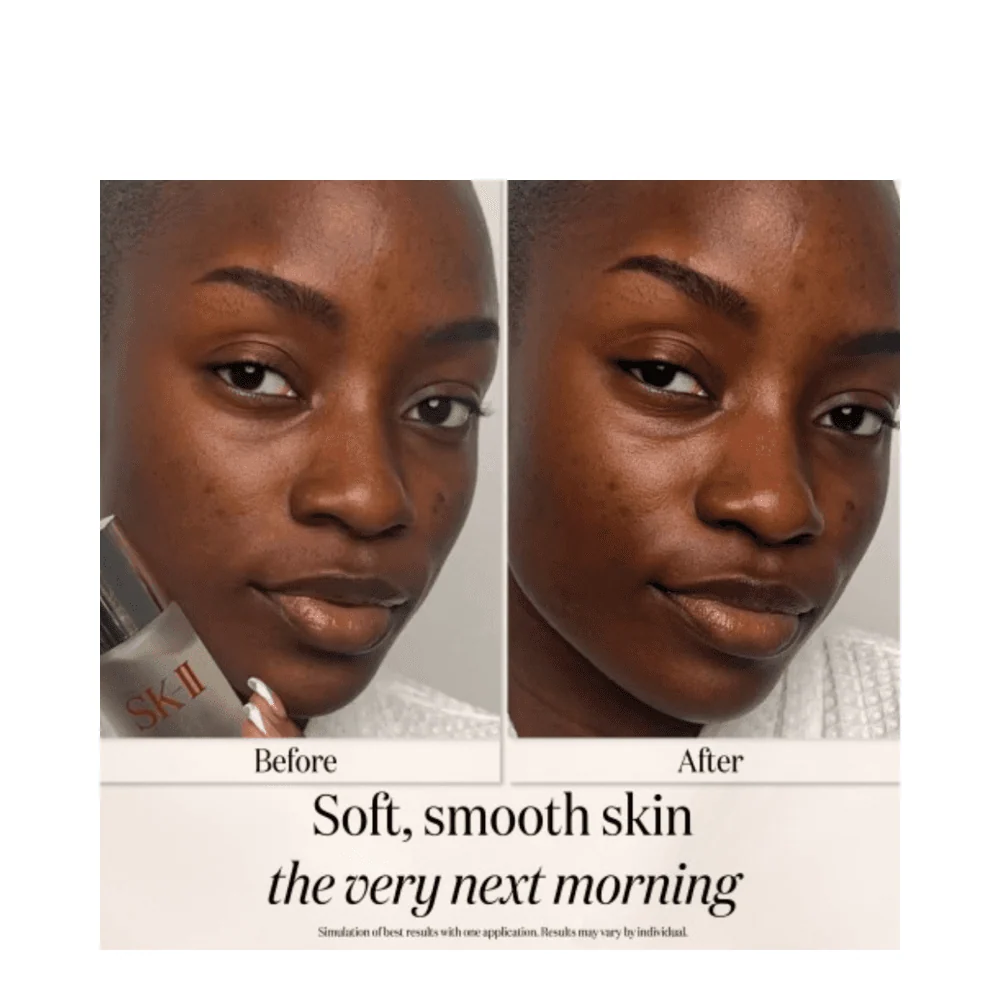 SK-II-kasvohoito Essence