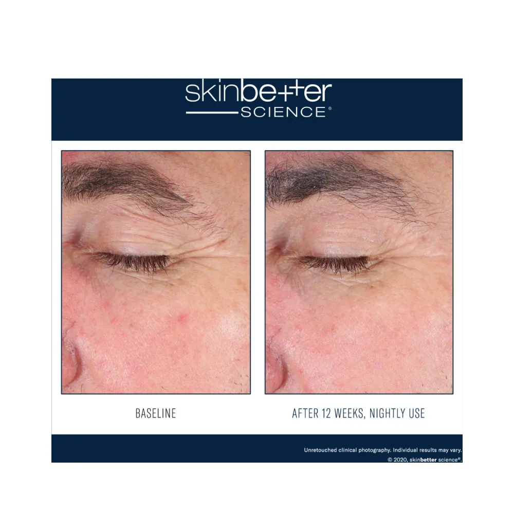 Skinbetter Science Eyemax Alpharet yön yli kerma