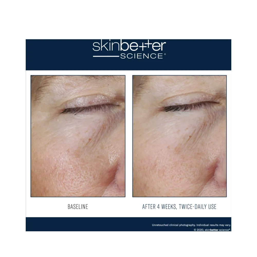 Skinbetter Science Instant Effect Gel Eye