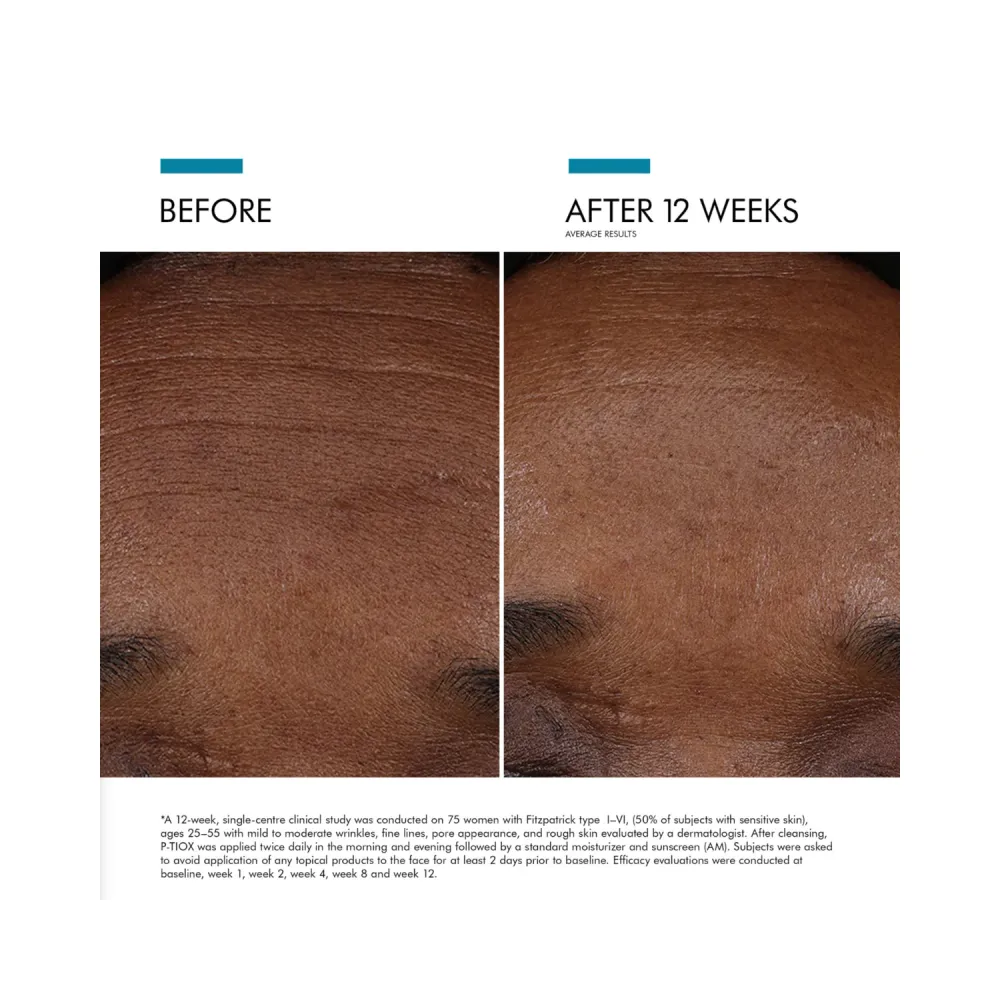 Skinceuticals P-Tiox anti-ryppyjä peptidiseerumi