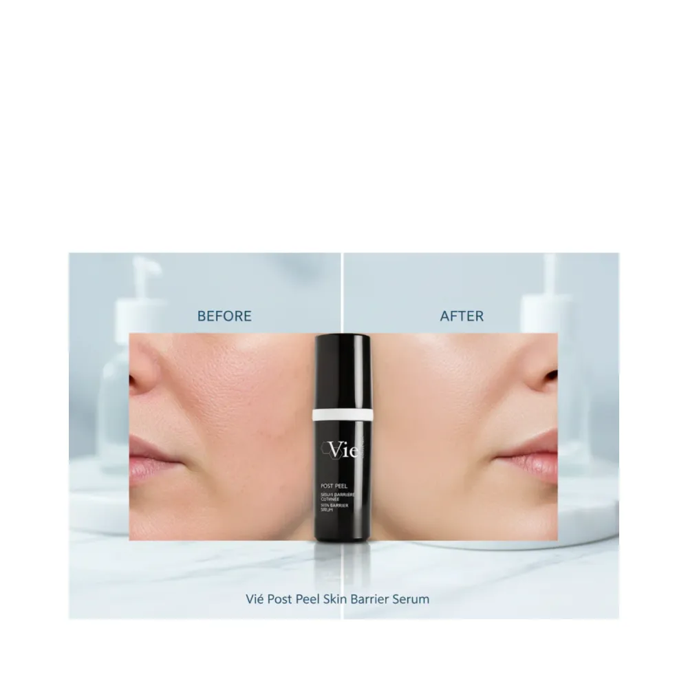Vie Collection Post Peel Skin Barrier Serum